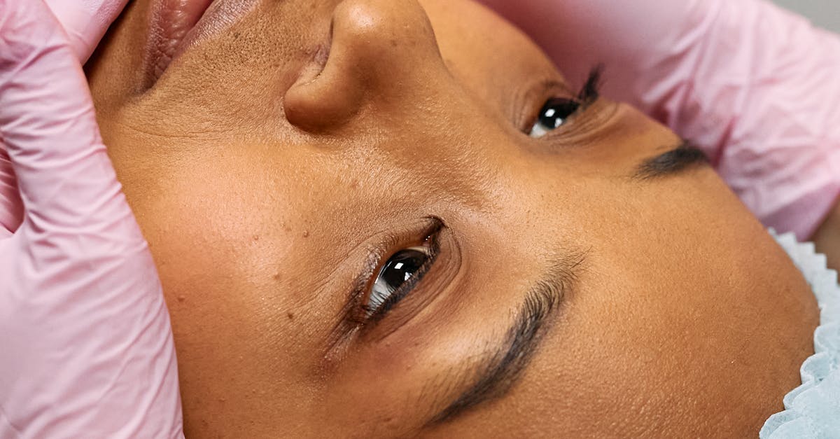 Facial Acupuncture: Enhancing the Overall Experience of Medical Spa Treatments