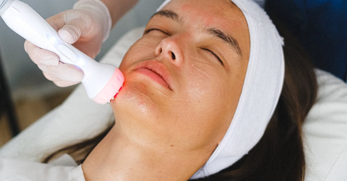 The Benefits of Chemical Peels for Skin Rejuvenation